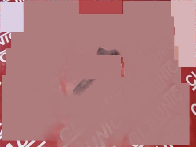 bontott DACIA SOLENZA Jobb Kormánykapcsoló Ablaktörlő